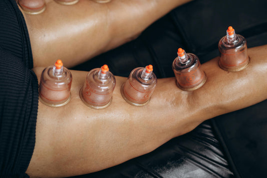 Cupping