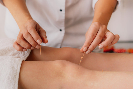 Acupuncture